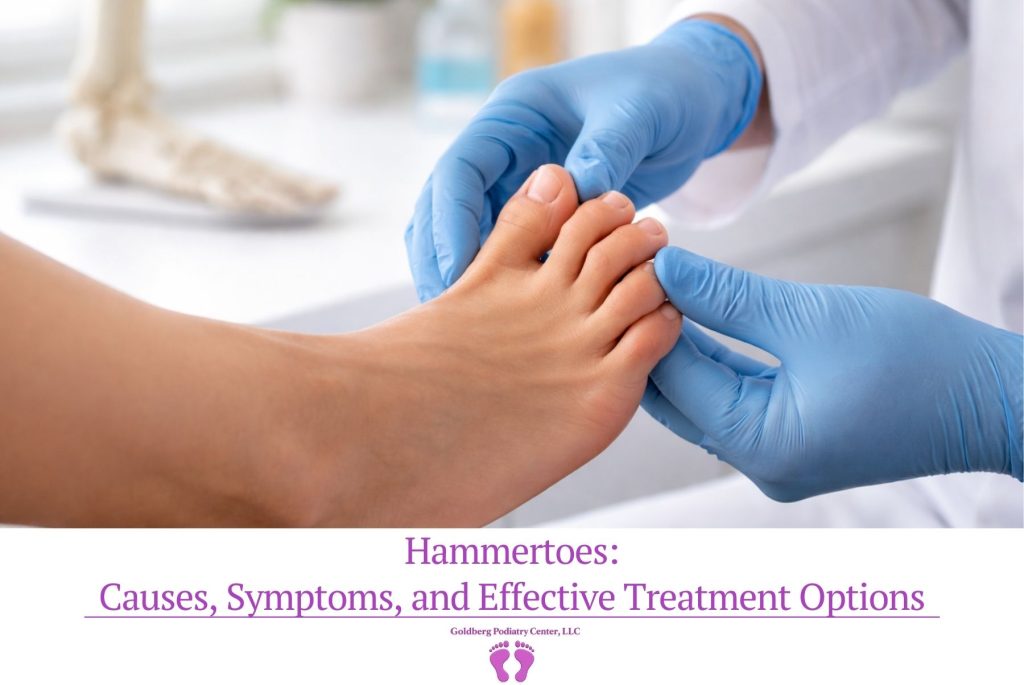 Hammertoes Causes, Symptoms, and Effective Treatment Options